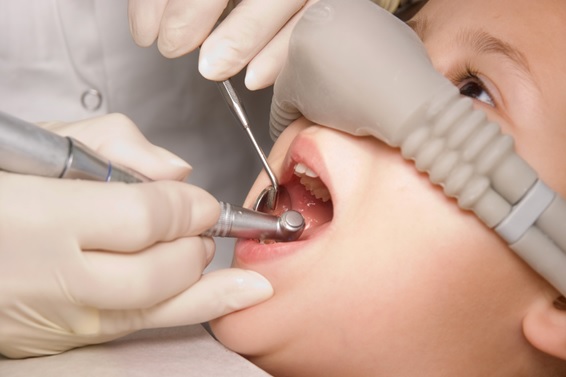 Sedación por oxido nitroso en clinicas dentales